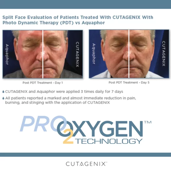 Cutagenix Treatment